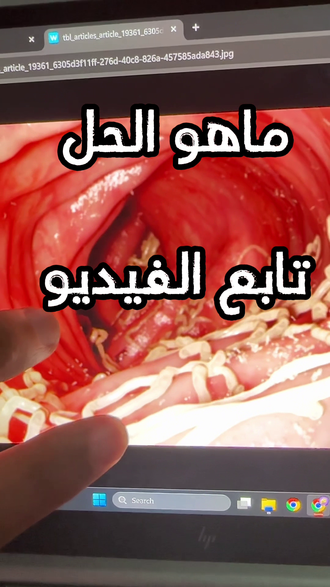 Translation missing: ar.sections.video.load_video